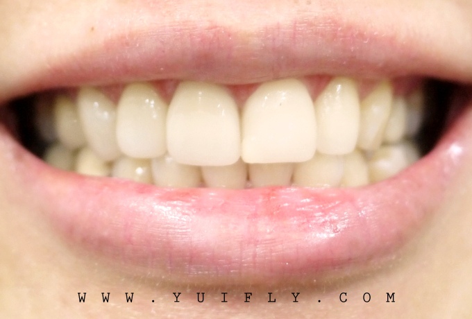 悅庭牙醫_19.jpg 悅庭牙醫_19.jpg