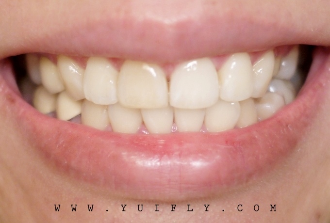 悅庭牙醫_20.jpg 悅庭牙醫_20.jpg