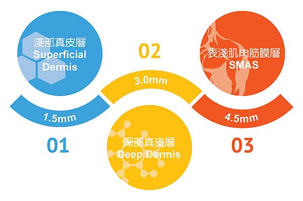 音波拉提完整解析2.jpg 音波拉提完整解析2.jpg