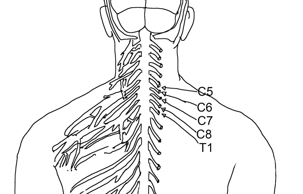 臂神經-C5-T1.jpg