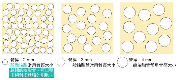 顯微套管抽脂手術費用價錢優點效果特色懶人包-1103-2.jpg