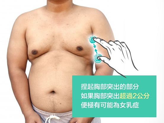 女乳症該如何判別 兩招方式做檢測 自己也能分辨正常乳房及女乳症差異 台中林雍球醫師 整形外科林雍球醫師 痞客邦 女乳症該如何判別 兩招方式做檢測 自己也能分辨正常乳房及女乳症差異 台中林雍球醫師 整形外科林雍球醫師 痞客邦