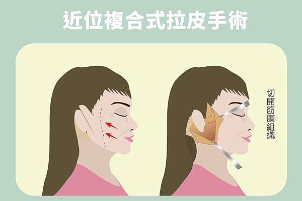 上傳 上傳