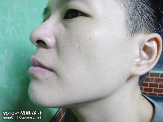 紫馨抗痘組合22.jpg 紫馨抗痘組合22.jpg