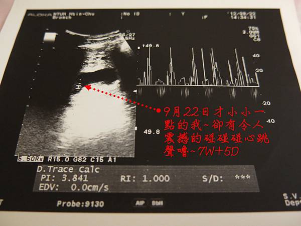 20120922第一次產檢PO