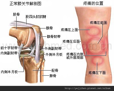 預防退化性膝關節炎-06