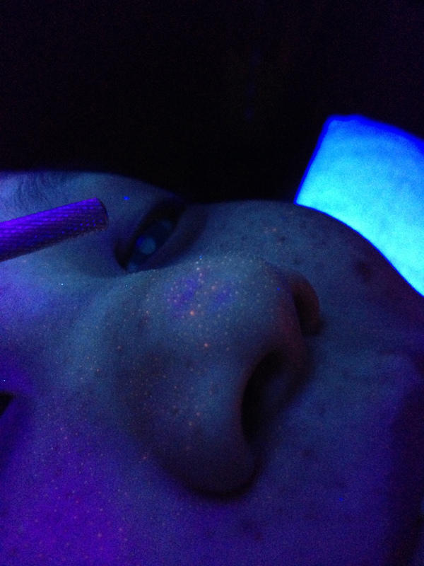 皮膚檢測-鼻頭.jpg