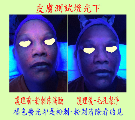 皮膚測試燈光下-護理前後.png