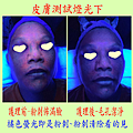 皮膚測試燈光下-護理前後.png