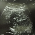 baby20100206_2.jpg