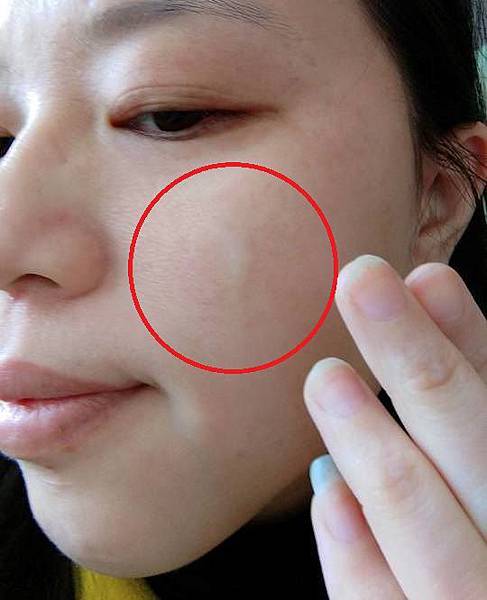 Q阿寶純質精華液4 試用