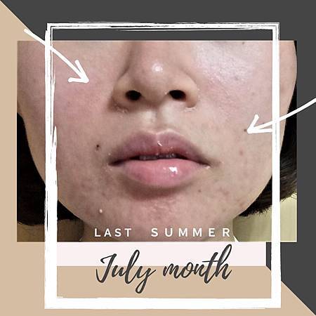 泛紅 2 藥品柔潔凝膠0 75 Metrogel O 75 嗨 請移步到這個網站zula Land 痞客邦