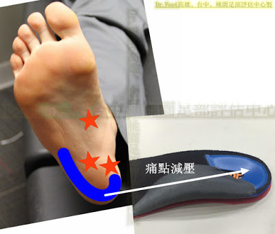 足底筋膜炎鞋墊.足弓墊.腳弓墊.足弓鞋墊.量身訂製鞋墊.客製化鞋墊.高雄鞋墊.足跟痛鞋墊.後跟痛鞋墊 足底筋膜炎鞋墊.足弓墊.腳弓墊.足弓鞋墊.量身訂製鞋墊.客製化鞋墊.高雄鞋墊.足跟痛鞋墊.後跟痛鞋墊