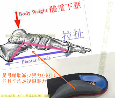 足底筋膜炎.後跟痛.足跟痛.腳底內側痛.腳後跟疼痛.早上起床痛.腳底筋膜炎.高雄鞋墊.量身訂製鞋墊.客製化鞋墊.足底筋膜炎鞋墊.足底筋膜炎治療.鞋墊推薦 足底筋膜炎.後跟痛.足跟痛.腳底內側痛.腳後跟疼痛.早上起床痛.腳底筋膜炎.高雄鞋墊.量身訂製鞋墊.客製化鞋墊.足底筋膜炎鞋墊.足底筋膜炎治療.鞋墊推薦.足弓墊..足弓鞋墊.腳弓墊.矯正鞋墊.矯正墊.健康鞋