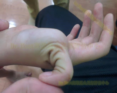 韌帶鬆弛,扁平足,鞋墊,矯正鞋墊.jpg 韌帶鬆弛,扁平足,鞋墊,矯正鞋墊.jpg