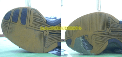 扁平足,矯正鞋2.png 扁平足,矯正鞋2.png