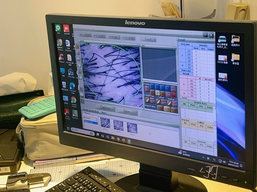 [植眉推薦]DCDC生髮診所朱冠州醫師眉毛稀疏救星!第三代