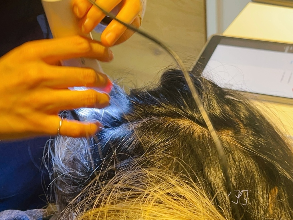 [植眉推薦]DCDC生髮診所朱冠州醫師眉毛稀疏救星!第三代