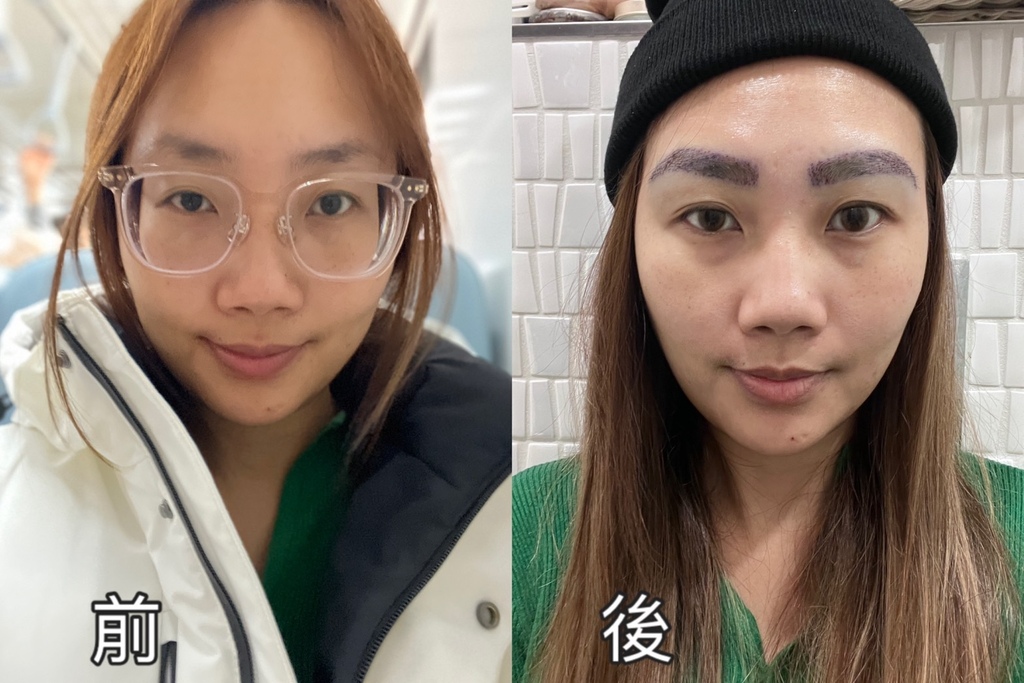 [植眉推薦]DCDC生髮診所朱冠州醫師眉毛稀疏救星!第三代