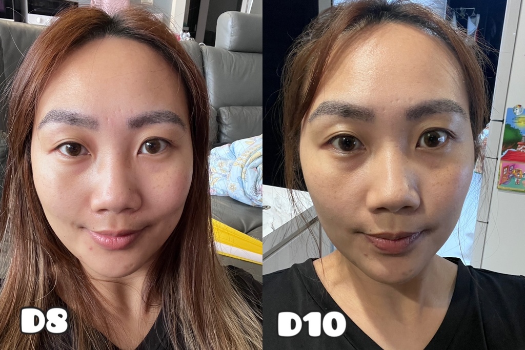 [植眉推薦]DCDC生髮診所朱冠州醫師眉毛稀疏救星!第三代