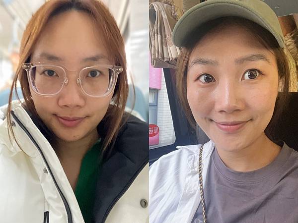 [植眉推薦]DCDC生髮診所朱冠州醫師眉毛稀疏救星!第三代